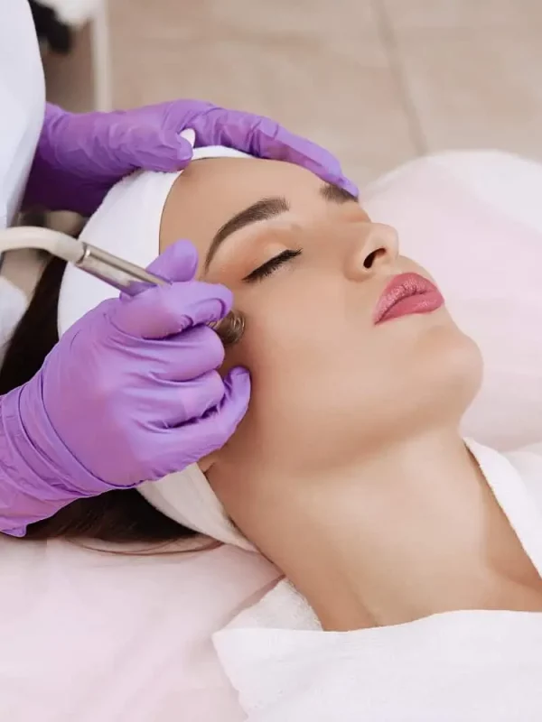 Microdermabrasion-wywcenter-in-st.-peters-mo