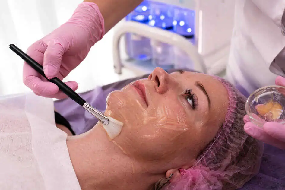 Chemical Peels by WYW Center LLC, DBA Whole You Wellness Center in St. Peters, MO
