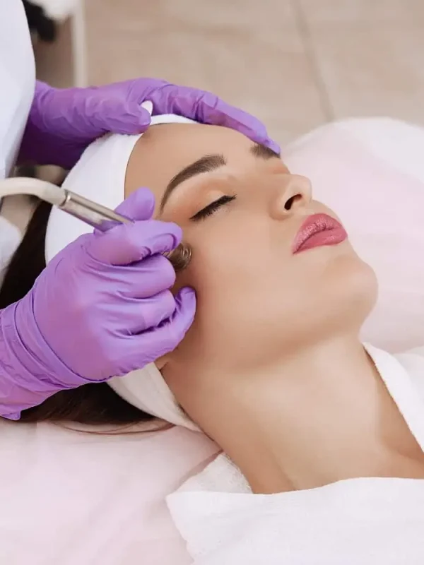 Microdermabrasion-wywcenter-in-st.-peters-mo