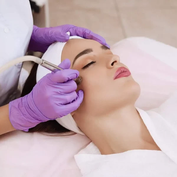 Microdermabrasion-wywcenter-in-st.-peters-mo